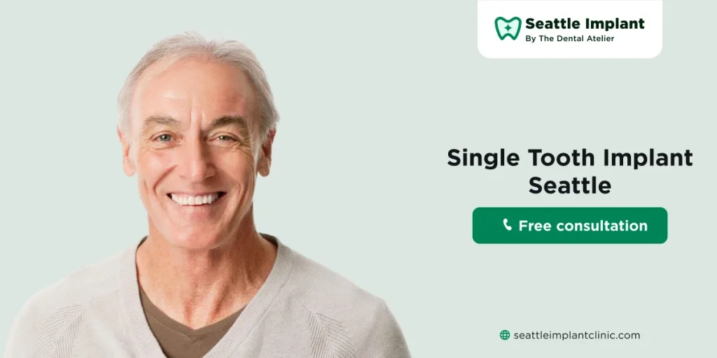 single tooth implants